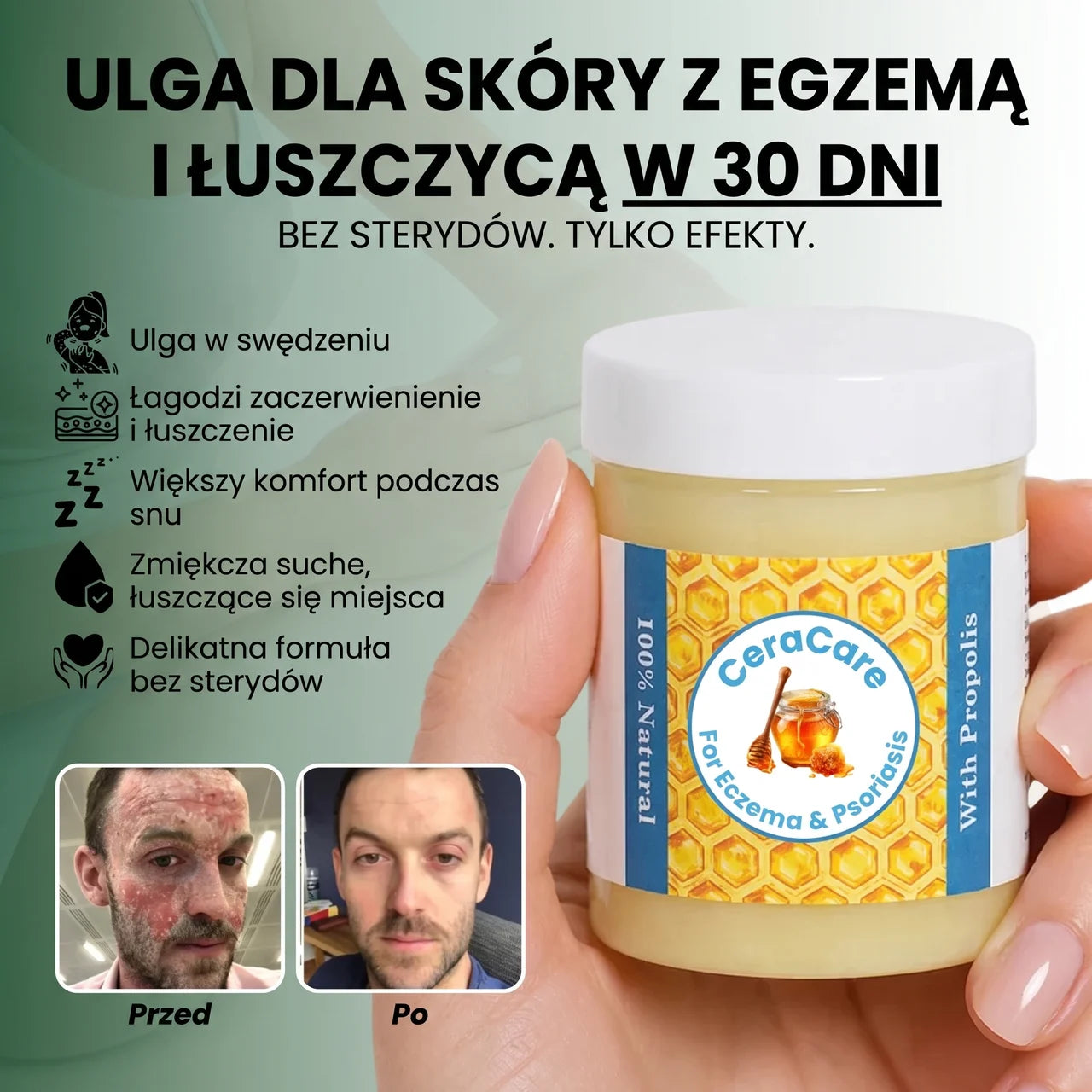 Balsam Regenerujący Na Egzemę I Łuszczycę