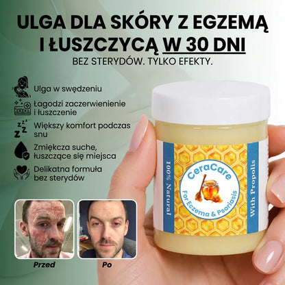 Balsam Regenerujący Na Egzemę I Łuszczycę
